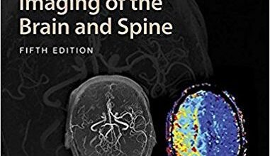 free-pdf-download-Magnetic Resonance Imaging of the Brain and Spine Fifth Edition