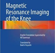 free-pdf-download-Magnetic Resonance Imaging of the Knee