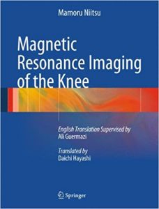 free-pdf-download-Magnetic Resonance Imaging of the Knee