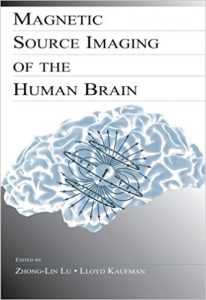 free-pdf-download-Magnetic Source Imaging of the Human Brain 1st Edition