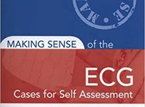 free-pdf-download-Making Sense of the ECG: Cases for Self Assessment 2nd Edition