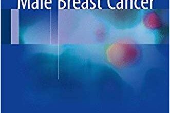 free-pdf-download-Male Breast Cancer 1st ed