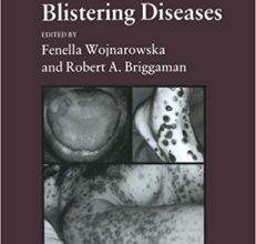 free-pdf-download-Management of Blistering Diseases Softcover reprint of the original 1st ed