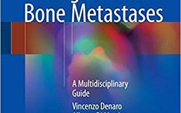 free-pdf-download-Management of Bone Metastases: A Multidisciplinary Guide 1st ed. 2019