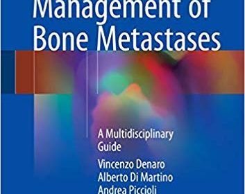 free-pdf-download-Management of Bone Metastases: A Multidisciplinary Guide 1st ed. 2019