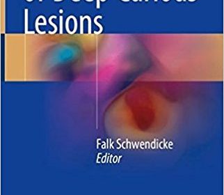 free-pdf-download-Management of Deep Carious Lesions 1st ed