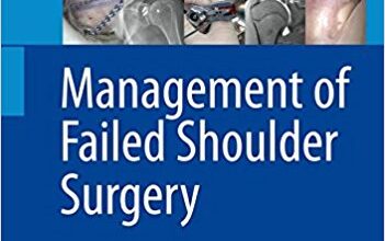 free-pdf-download-Management of Failed Shoulder Surgery 1st ed. 2018 Edition