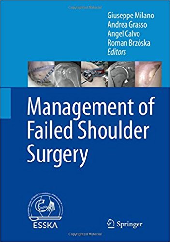 free-pdf-download-Management of Failed Shoulder Surgery 1st ed. 2018 Edition