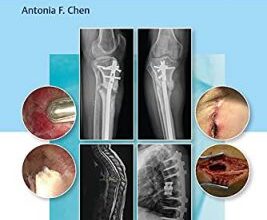 free-pdf-download-Management of Orthopaedic Infections: A Practical Guide