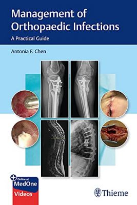 free-pdf-download-Management of Orthopaedic Infections: A Practical Guide