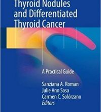 free-pdf-download-Management of Thyroid Nodules and Differentiated Thyroid Cancer: A Practical Guide 1st ed. 2017 Edition