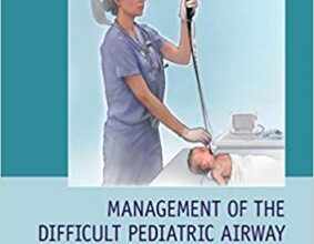 free-pdf-download-Management of the Difficult Pediatric Airway 1st Edition