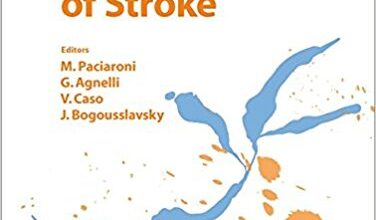 free-pdf-download-Manifestations of Stroke (Frontiers of Neurology and Neuroscience