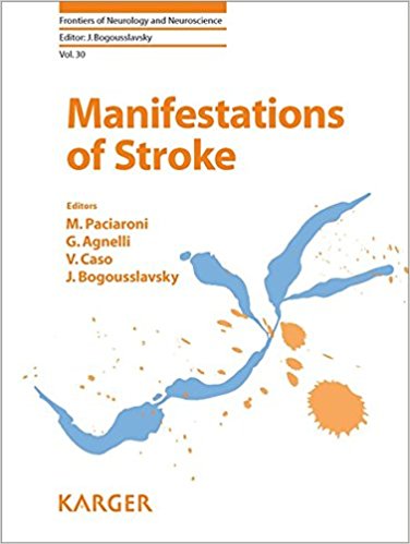 free-pdf-download-Manifestations of Stroke (Frontiers of Neurology and Neuroscience