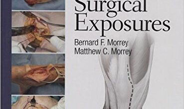 free-pdf-download-Master Techniques in Orthopaedic Surgery: Relevant Surgical Exposures First Edition