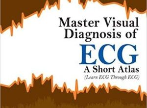 free-pdf-download-Master Visual Diagnosis of Ecg: A Short Atlas (Learn ECG Through Ecg) 1st Edition