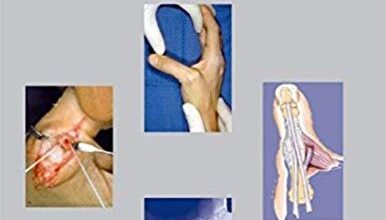 free-pdf-download-MasterCases in Hand and Wrist Surgery 1st Edition