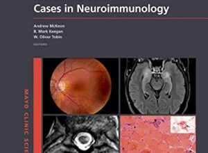 free-pdf-download-Mayo Clinic Cases in Neuroimmunology