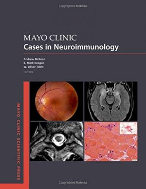 free-pdf-download-Mayo Clinic Cases in Neuroimmunology