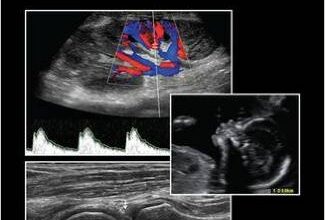 free-pdf-download-Measurement in Ultrasound