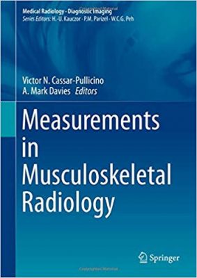 free-pdf-download-Measurements in Musculoskeletal Radiology (Medical Radiology)