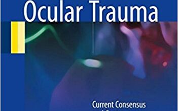 free-pdf-download-Mechanical Ocular Trauma: Current Consensus and Controversy 1st ed. 2017 Edition