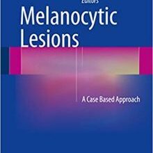 free-pdf-download-Melanocytic Lesions: A Case Based Approach