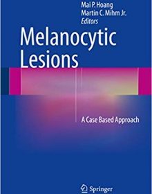 free-pdf-download-Melanocytic Lesions: A Case Based Approach