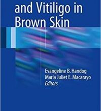 free-pdf-download-Melasma and Vitiligo in Brown Skin 1st ed. 2017 Edition