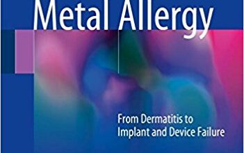 free-pdf-download-Metal Allergy: From Dermatitis to Implant and Device Failure 1st ed. 2018 Edition