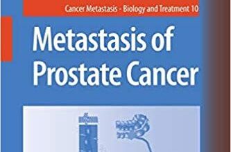 free-pdf-download-Metastasis of Prostate Cancer (Cancer Metastasis – Biology and Treatment)