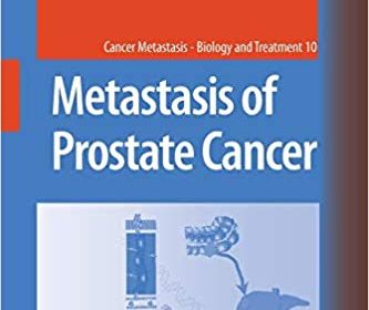 free-pdf-download-Metastasis of Prostate Cancer (Cancer Metastasis – Biology and Treatment)