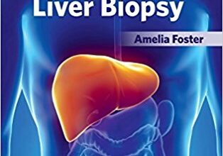 free-pdf-download-Methods and Results of Liver Biopsy