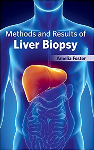 free-pdf-download-Methods and Results of Liver Biopsy