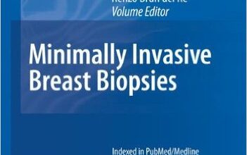 free-pdf-download-Minimally Invasive Breast Biopsies (Recent Results in Cancer Research) 2010th Edition