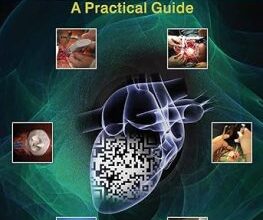 free-pdf-download-Minimally Invasive Cardiac Surgery: A Practical Guide