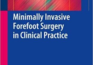 free-pdf-download-Minimally Invasive Forefoot Surgery in Clinical Practice