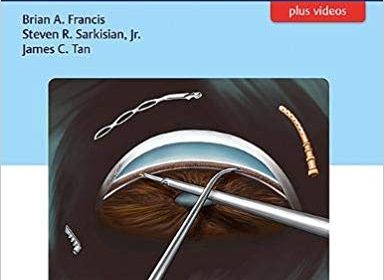 free-pdf-download-Minimally Invasive Glaucoma Surgery: A Practical Guide 1st Edition