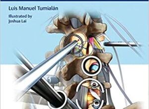 free-pdf-download-Minimally Invasive Spine Surgery: A Primer