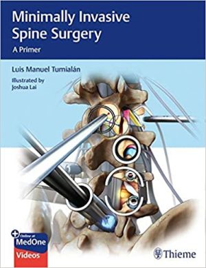 free-pdf-download-Minimally Invasive Spine Surgery: A Primer