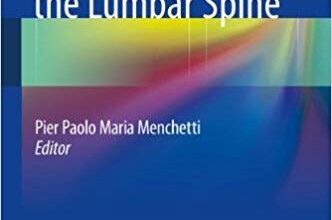 free-pdf-download-Minimally Invasive Surgery of the Lumbar Spine