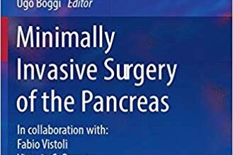 free-pdf-download-Minimally Invasive Surgery of the Pancreas (Updates in Surgery)