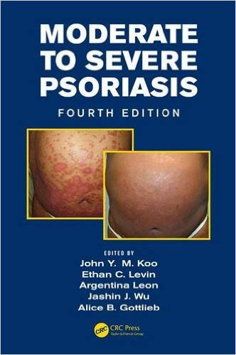 free-pdf-download-Moderate to Severe Psoriasis