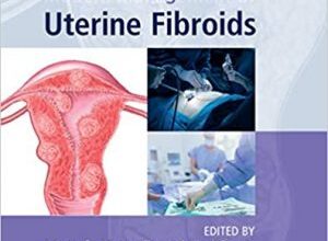 free-pdf-download-Modern Management of Uterine Fibroids