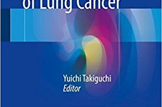 free-pdf-download-Molecular Targeted Therapy of Lung Cancer 1st ed. 2017 Edition