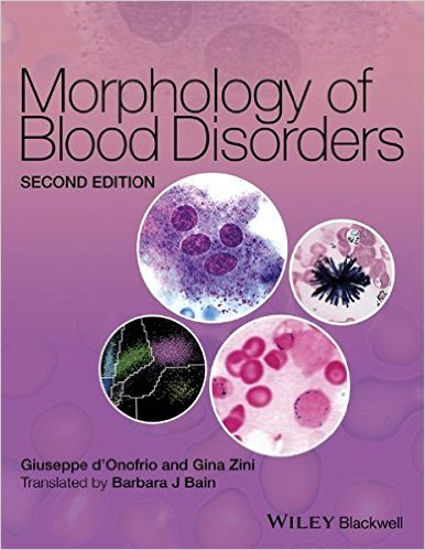 free-pdf-download-Morphology of Blood Disorders