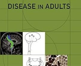 free-pdf-download-Motor Neuron Disease in Adults (Contemporary Neurology Series) 1st Edition