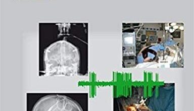 free-pdf-download-Movement Disorder Surgery: The Essentials 1st Edition