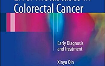 free-pdf-download-Multidisciplinary Management of Liver Metastases in Colorectal Cancer: Early Diagnosis and Treatment 1st ed. 2017 Edition