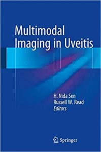 free-pdf-download-Multimodal Imaging in Uveitis 1st ed. 2018 Edition